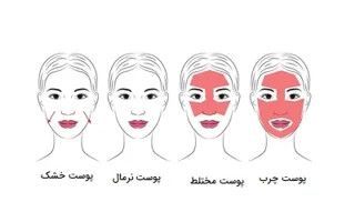 آشنایی با انواع پوست